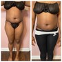 3 Laser Lipo or 3 Fat Cavitation