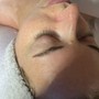 Microdermabrasion Facial