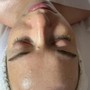 Microdermabrasion Facial