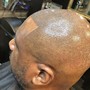 Bald head Thermal shave