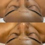 Brow Shaping