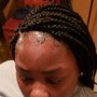 Scalp Treatment