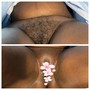 Brazilian Wax