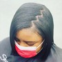 Scalp Treatment