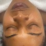 "BACK FACIAL " Treatment