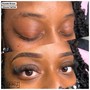 Brow Correction