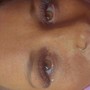 Eyelash Extension Removal