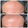 PRO POWER EYE PEEL