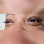 Eyelash Extension Removal