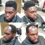 Fiber Enhancement/Hairline Only