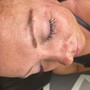 Eyelash Extension Removal