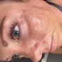 Eyelash Extension Removal