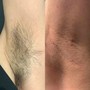 Men’s Brazilian Wax