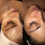 Back Facial