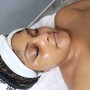 Three Acne Facial