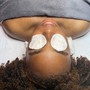 Microdermabrasion