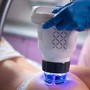 intelligent ice blue hydro dermabrasion oxygen facial