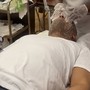 Microdermabrasion