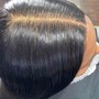 Scalp Treatment