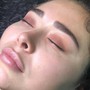 Chemical peel Facial treatment