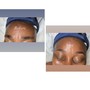 Preteen/Teen Facial