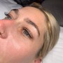 Eyelash Extension Removal