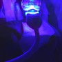 Pro Teeth Whitening 30 Minutes