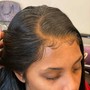 Scalp Treatment