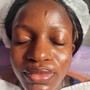 Exfoliating Microdermabrasion Treatment