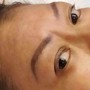 Brow Correction and Shading