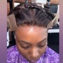 scalp treatment