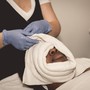 Microdermabrasion