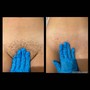 Mens Brazilian Wax and Brojacial