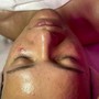 Microdermabrasion Facial