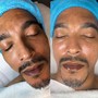 Oxygen Facial