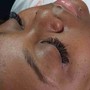 Deluxe facial W/Acne Treatment