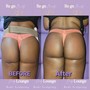 Goddess body Butt Enhancement and Waist Contouring(SINGLE SESSION ONLY)