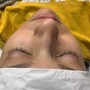 Individual Eyelash Extension Removal