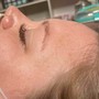 Eyelash Extension Removal