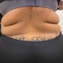 Breast/Butt Lift Cupping