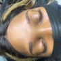 Scalp Treatment