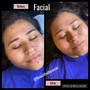 Facial