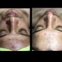 Eyelash Extension Removal