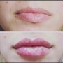 Lips