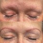 Permanent Makeup Removal