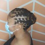 Scalp Treatment