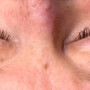 Eyelash Extension Removal