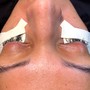 Eyelash Extension Removal