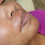 Oxygen Facial