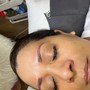 Dermaplaning